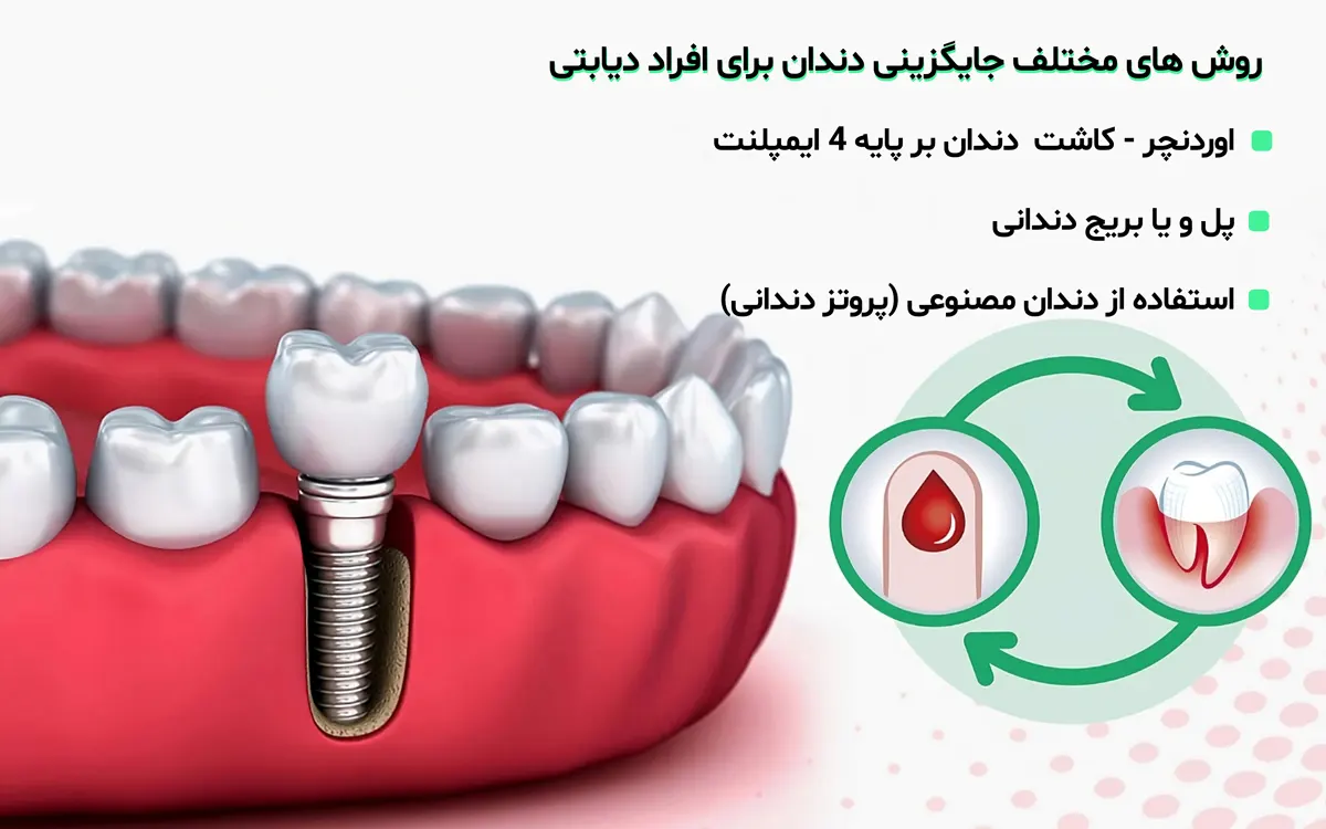 روش های جایگزینی دندان در افراد دیابتی انسولین