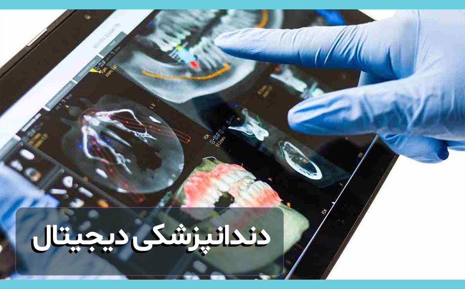 دندانپزشکی-دیجیتال-در-1402