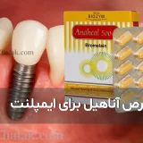 قرص آناهیل برای ایمپلنت | کاهش التهاب و تسریع ترمیم بعد از جراحی دندان