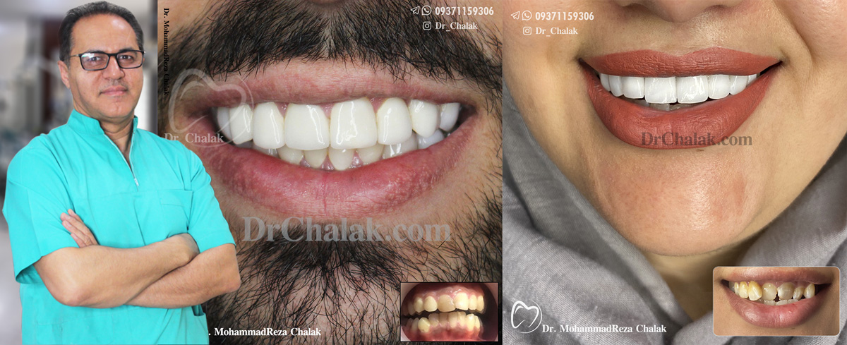 دندانپزشک زیبایی مشهد