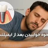نحوه خوابیدن بعد از ایمپلنت