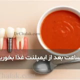 چند ساعت بعد از ایمپلنت غذا بخوریم؟ | راهنمای کامل تغذیه بعد از ایمپلنت دندان