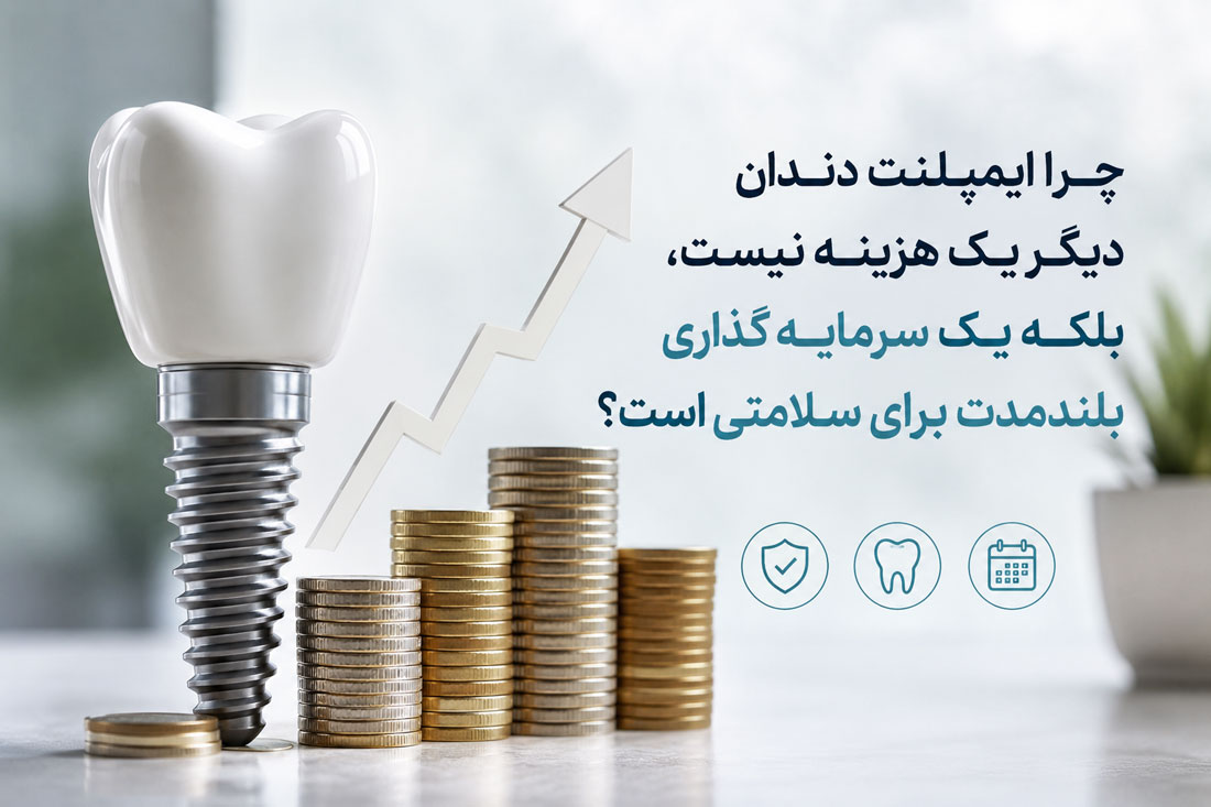 ایمپلنت دندان دیگر یک هزینه نیست